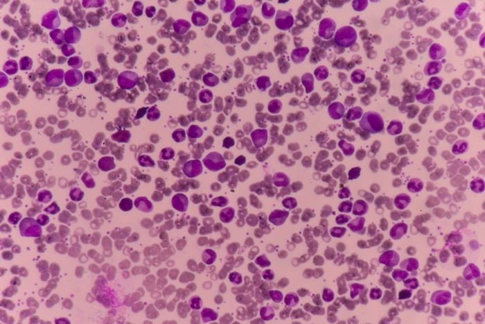 Imagem colorida de células sanguíneas em microscópio - Metrópoles
