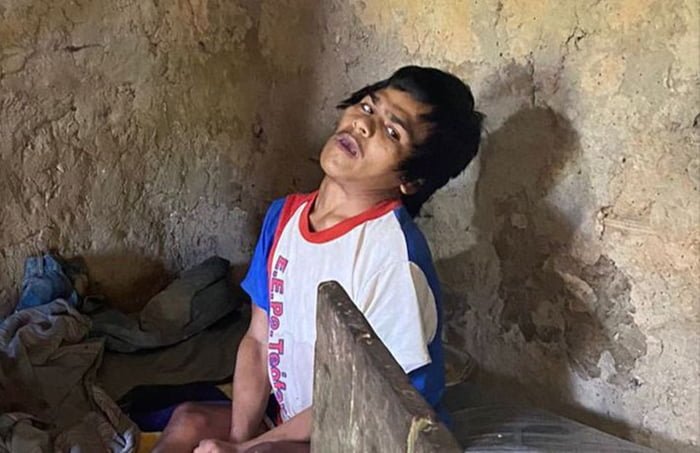 Imagem colorida de jovem com deficiência morto pelo próprio pai em São José da Laje (AL) - Metrópoles