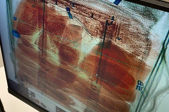 Foto de raio-x mostrando drogas em mala - Metrópoles