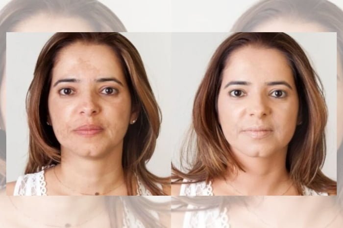 Foto colorida de uma mulher antes e depois - Metrópoles